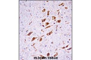 Mouse Pak3 Antibody (N-term) ((ABIN657852 and ABIN2846813))immunohistochemistry analysis in formalin fixed and paraffin embedded mouse brain tissue followed by peroxidase conjugation of the secondary antibody and DAB staining. (PAK3 Antikörper  (N-Term))