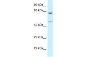 Image no. 1 for anti-Asparaginyl-tRNA Synthetase (NARS) (AA 43-92) antibody (ABIN6747536)
