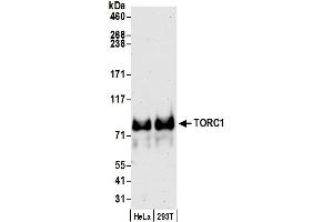 Western Blotting (WB) image for anti-CREB Regulated Transcription Coactivator 1 (CRTC1) (C-Term) antibody (ABIN7453901) (CRTC1 Antikörper  (C-Term))