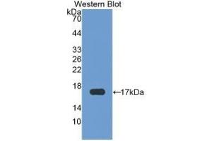 Detection of Recombinant CHEM, Human using Monoclonal Antibody to Chemerin (CHEM)