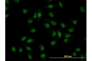 Immunofluorescence of monoclonal antibody to CLK3 on HeLa cell.