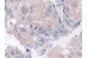 Immunohistochemistry (IHC) image for anti-ADAM Metallopeptidase with Thrombospondin Type 1 Motif, 10 (ADAMTS10) (AA 239-602) antibody (ABIN7443695)