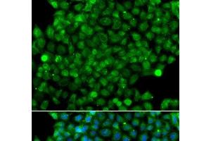 Immunofluorescence analysis of A549 cells using CFHR3 Polyclonal Antibody