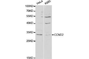 Western Blotting (WB) image for anti-Cyclin D2 (CCND2) antibody (ABIN1875413) (Cyclin D2 Antikörper)