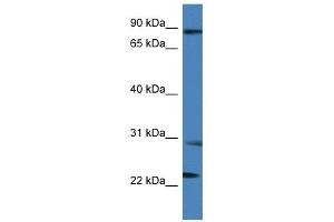 Western Blot showing MIA2 antibody used at a concentration of 1 ug/ml against THP-1 Cell Lysate (MIA2 Antikörper  (C-Term))