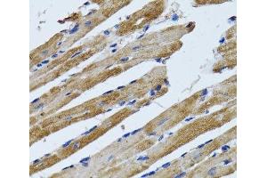 Immunohistochemistry of paraffin-embedded Rat heart using ATP5B Polyclonal Antibody at dilution of 1:100 (40x lens).