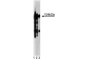 Western blot analysis of Intergrin beta3 on a human platelet lysate. (Integrin beta 3 Antikörper  (AA 592-712))