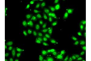 Immunofluorescence analysis of U2OS cells using PIAS3 antibody (ABIN6290743).