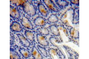 Used in DAB staining on fromalin fixed paraffin-embedded bowels tissue (TMSB4X Antikörper  (AA 1-44))