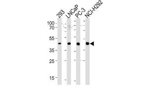 Western Blotting (WB) image for anti-Steroid 5 alpha-Reductase 3 (SRD5A3) antibody (ABIN3002292) (SRD5A3 Antikörper)