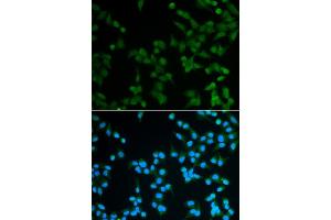 Immunofluorescence analysis of A549 cell using SPIN1 antibody. (Spindlin 1 Antikörper)