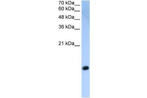 HIST2H2AC antibody used at 2. (HIST2H2AC Antikörper  (Middle Region))