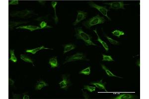 Immunofluorescence of monoclonal antibody to PCBP2 on HeLa cell. (PCBP2 Antikörper  (AA 1-362))