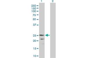 Western Blot analysis of CD70 expression in transfected 293T cell line by CD70 MaxPab polyclonal antibody. (CD70 Antikörper  (AA 1-193))