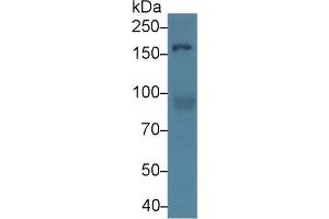 Western Blot; Sample: Human Hela cell lysate; Primary Ab: 2µg/ml Rabbit Anti-Mouse Rock1 Antibody Second Ab: 0.