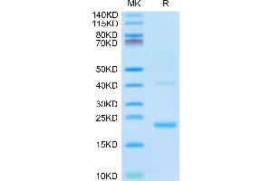 SDS-PAGE (SDS) image for Interleukin 21 (IL21) (AA 18-146) protein (His-Avi Tag,Biotin) (ABIN7274926)