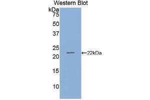 Western blot analysis of the recombinant protein. (RBP4 Antikörper  (AA 19-201))