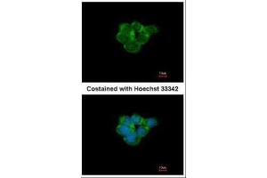 ICC/IF Image Immunofluorescence analysis of methanol-fixed A431, using Nicotinic Acetylcholine Receptor alpha 3, antibody at 1:500 dilution. (CHRNA3 Antikörper  (Center))