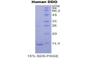 SDS-PAGE (SDS) image for D-Aspartate Oxidase (DDO) (AA 117-199) protein (His tag) (ABIN1079347) (DDO Protein (AA 117-199) (His tag))