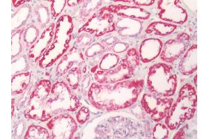 Human Kidney: Formalin-Fixed, Paraffin-Embedded (FFPE) (GPR81 Antikörper  (Cytoplasmic Domain))