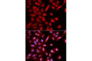 Immunofluorescence (IF) image for anti-Proteasome (Prosome, Macropain) 26S Subunit, ATPase, 3 (PSMC3) (AA 1-180) antibody (ABIN3022705)