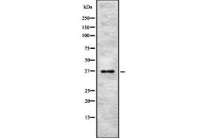 PINX1 Antikörper  (Internal Region)