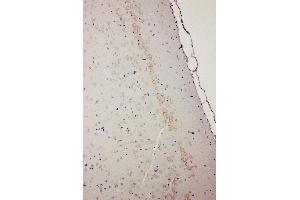 Anti-Dopamine Receptor D1 antibody, IHC(P) IHC(P): Rat Brain Tissue (Dopamine Receptor d1 Antikörper  (Middle Region))