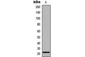 Western blot analysis of RhoXF1 expression in Jurkat (A) whole cell lysates. (RHOXF1 Antikörper  (C-Term))