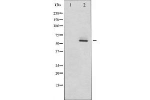 Western blot analysis of Estrogen Receptor-beta expression in EGF treated HeLa whole cell lysates,The lane on the left is treated with the antigen-specific peptide. (ESR2 Antikörper)