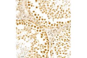 Immunohistochemistry of paraffin embedded rat testis using BPTF (ABIN7073234) at dilution of 1:1000 (400x lens) (BPTF Antikörper)