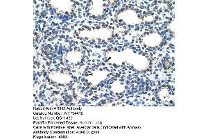Human Lung (ARIH2 Antikörper  (N-Term))