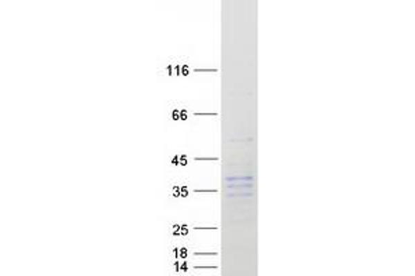Kallikrein 9 Protein (KLK9) (Myc-DYKDDDDK Tag)
