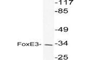 Western blot analysis of FOXE3 in extracts from K562 cell using FOXE3 / FKHL12 antibody (FOXE3 Antikörper)