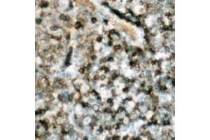 Immunohistochemical analysis of p47 phox (pS359) staining in human lymph node formalin fixed paraffin embedded tissue section. (NCF1 Antikörper  (C-Term, pSer359))