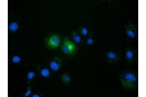 Anti-FSHB mouse monoclonal antibody (ABIN2453054) immunofluorescent staining of COS7 cells transiently transfected by pCMV6-ENTRY FSHB (RC214616). (FSHB Antikörper)