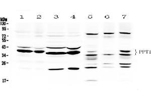 Western blot analysis of PPT1 using anti- PPT1 antibody . (PPT1 Antikörper  (C-Term))