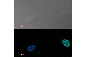 Immunocytochemistry detection of Ki-67 in U2OS cell line (human osteosarcoma) using monoclonal antibody Ki-67 (green).