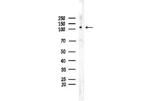 anti-Ras and Rab Interactor 3 (RIN3) (Internal Region) antibody