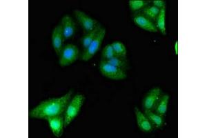 Immunofluorescent analysis of HepG2 cells using ABIN7157550 at dilution of 1:100 and Alexa Fluor 488-congugated AffiniPure Goat Anti-Rabbit IgG(H+L) (KIDINS220 Antikörper  (AA 1077-1370))