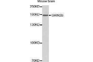 Western blot analysis of extracts of mouse brain, using GRIN2B antibody (ABIN2974534). (GRIN2B Antikörper)
