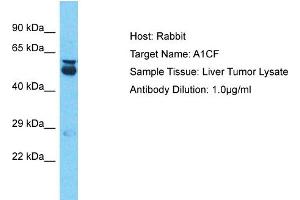 Host: Rabbit Target Name: A1CF Sample Type: Liver Tumor lysates Antibody Dilution: 1.