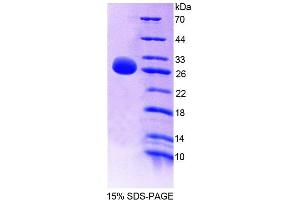 SDS-PAGE analysis of Rat GSTm4 Protein. (GSTM4 Protein)