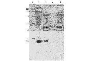 Western Blotting (WB) image for anti-Human Papilloma Virus 11 E7 (HPV-11 E7) (AA 36-70) antibody (ABIN781777) (Human Papilloma Virus 11 E7 (HPV-11 E7) (AA 36-70) Antikörper)