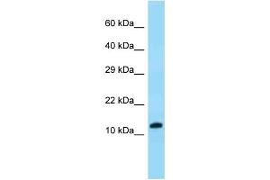 WB Suggested Anti-VKORC1 Antibody Titration: 1.