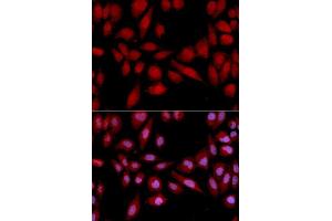 Immunofluorescence analysis of U2OS cell using PSMA2 antibody. (PSMA2 Antikörper  (AA 1-234))