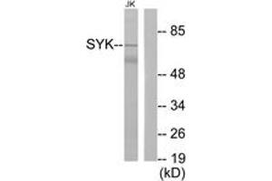 Western blot analysis of extracts from Jurkat cells, treated with UV 15', using SYK (Ab-348) Antibody. (SYK Antikörper  (AA 314-363))
