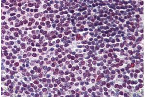 Human Spleen: Formalin-Fixed, Paraffin-Embedded (FFPE) (RCC1 Antikörper  (AA 312-421))