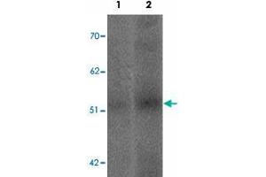 Western blot analysis of SLC39A14 in human spleen tissue lysate with SLC39A14 polyclonal antibody  at (1) 1 and (2) 2 ug/mL. (SLC39A14 Antikörper  (Internal Region))