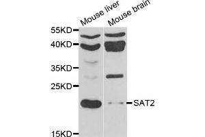 Western blot analysis of extracts of various cell lines, using SAT2 antibody. (SAT2 Antikörper)