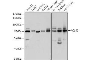Western blot analysis of extracts of various cell lines, using ACSS2 antibody (ABIN2560918) at 1:1000 dilution. (ACSS2 Antikörper)